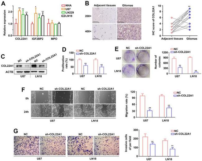 COL22A1 Antibody in Western Blot (WB)