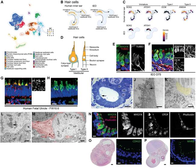 CDH23 Antibody in Immunohistochemistry (Paraffin) (IHC (P))