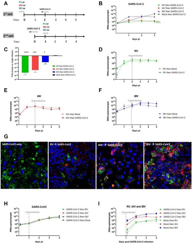 Rhinovirus VP3 Antibody in Immunocytochemistry (ICC/IF)