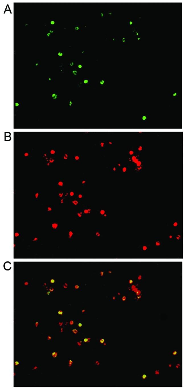 IL-17A Antibody in Immunohistochemistry, Immunocytochemistry (IHC, ICC/IF)