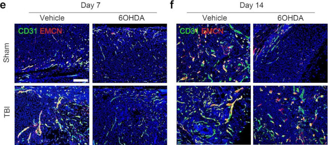 Goat IgG (H+L) Secondary Antibody in Immunohistochemistry (IHC)