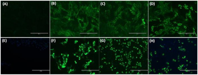 Coronavirus pan Antibody in Immunocytochemistry (ICC/IF)