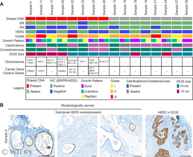 ErbB2 (HER-2) Antibody in Immunohistochemistry (IHC)