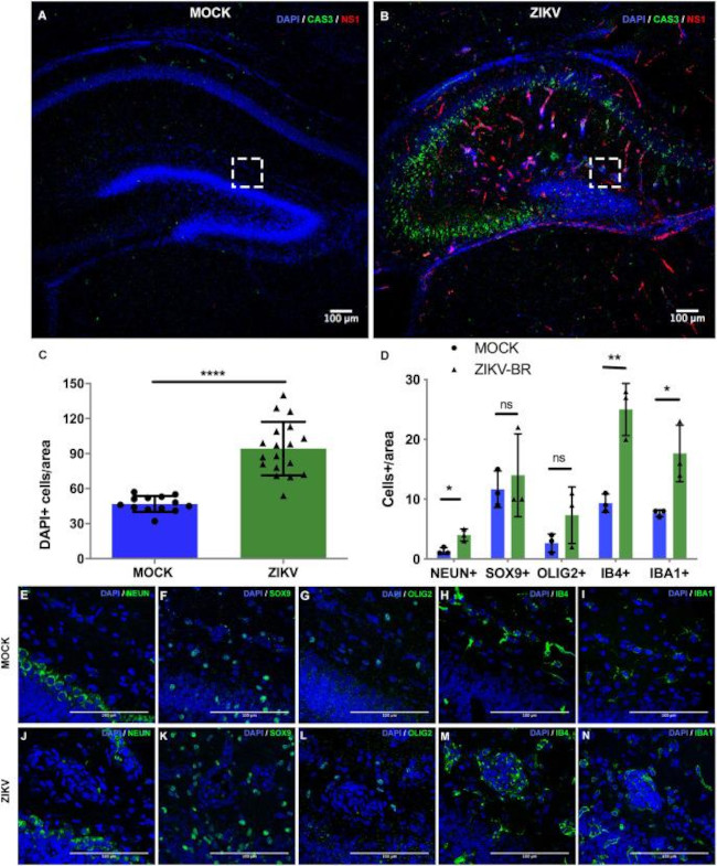 Zika Virus NS1 Antibody in Immunohistochemistry (IHC)
