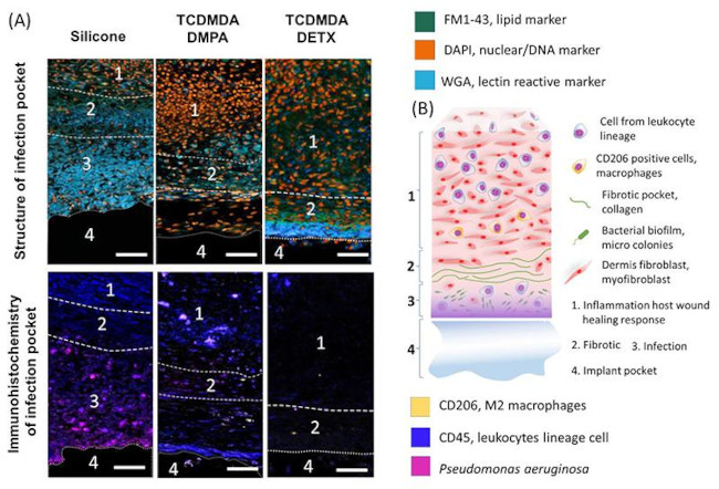 Pseudomonas Antibody in Immunocytochemistry (ICC/IF)