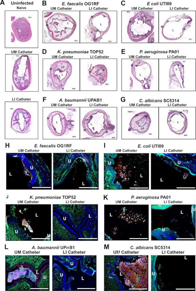 E. coli serotype O/K Antibody in Immunohistochemistry (IHC)