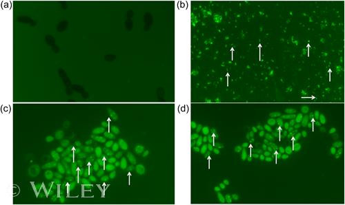 Helicobacter pylori Antibody in Immunocytochemistry (ICC/IF)