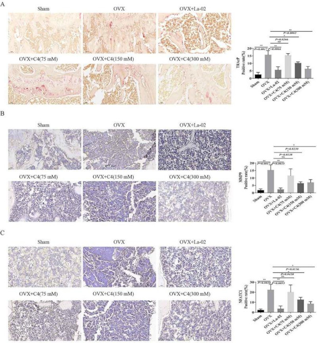 NFATC1 Antibody in Immunohistochemistry (IHC)