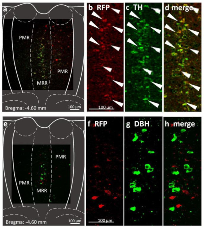 Dopamine beta Hydroxylase Antibody in Immunohistochemistry (IHC)