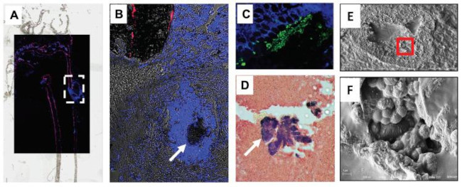 Staphylococcus aureus Antibody in Immunohistochemistry (IHC)