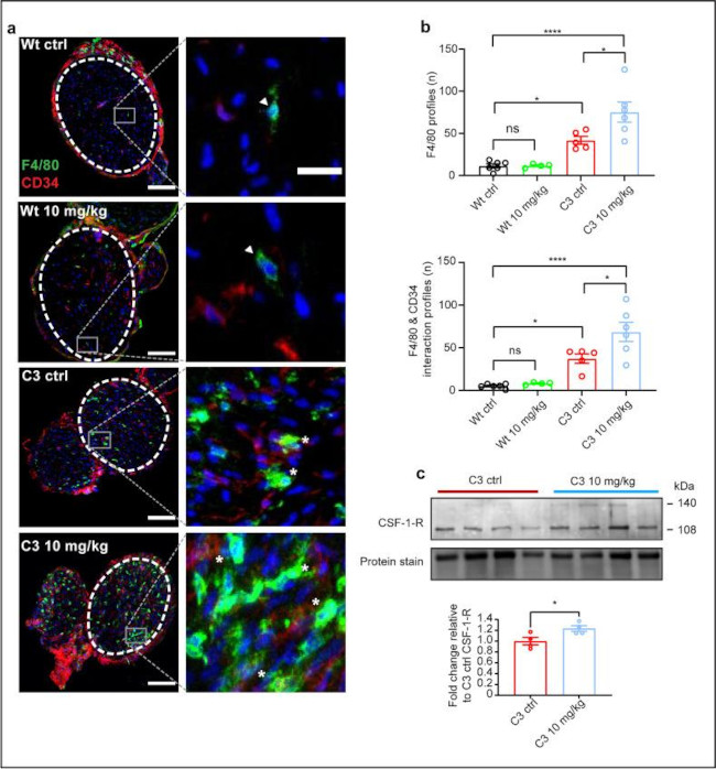 CD34 Antibody in Immunohistochemistry (IHC)