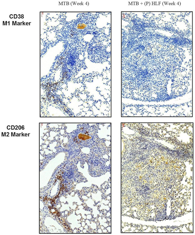 CD38 Antibody in Immunohistochemistry (IHC)