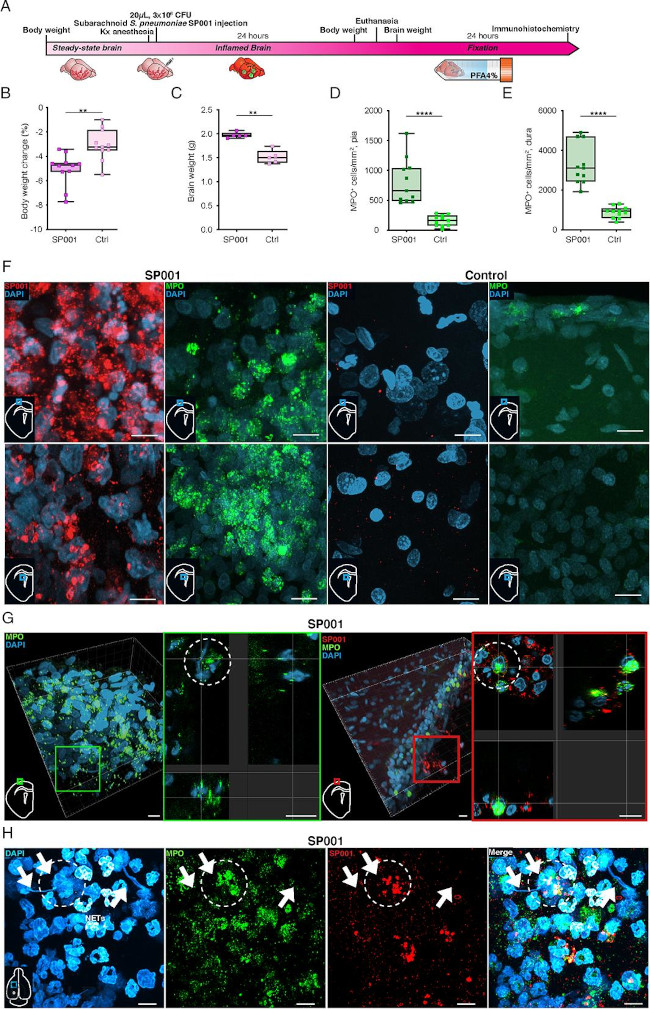 Streptococcus pneumoniae Antibody in Immunohistochemistry (IHC)