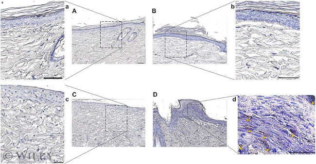 Pseudomonas Antibody in Immunohistochemistry (IHC)