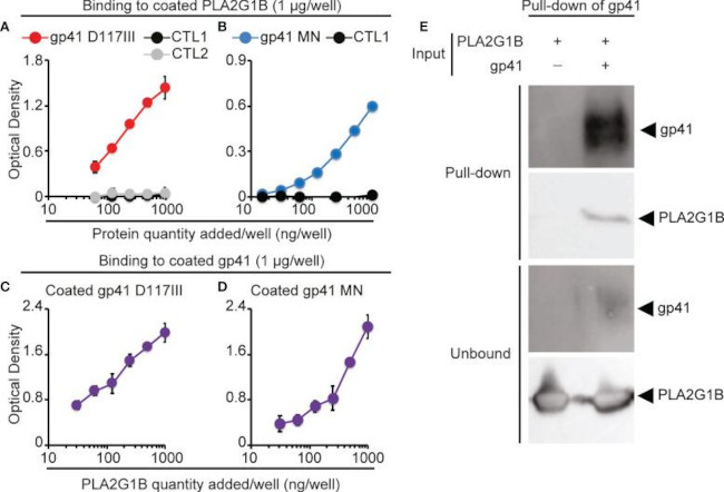 HIV1 gp41 Antibody in Western Blot (WB)