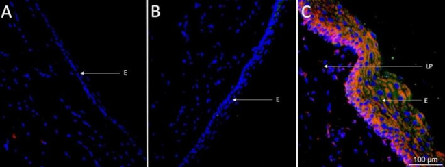 TNF alpha Antibody in Immunohistochemistry (IHC)