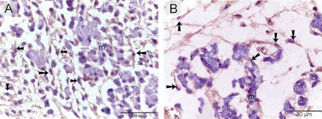 VEGF Antibody in Immunohistochemistry (Paraffin) (IHC (P))