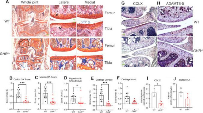 ADAMTS5 Antibody in Immunohistochemistry (Paraffin) (IHC (P))