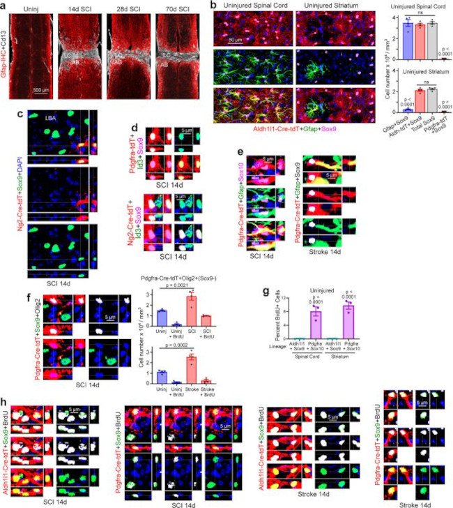 SOX9 Antibody in Immunohistochemistry (IHC)
