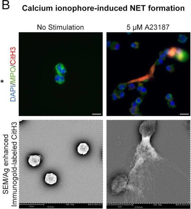 Goat IgG (H+L) Cross-Adsorbed Secondary Antibody in Immunocytochemistry (ICC/IF)