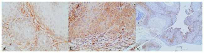 NOTCH1 Antibody in Immunohistochemistry (Paraffin) (IHC (P))