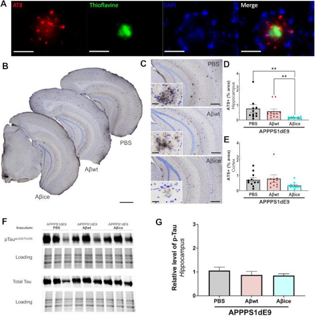 Phospho-Tau (Ser202, Thr205) Antibody in Western Blot (WB)