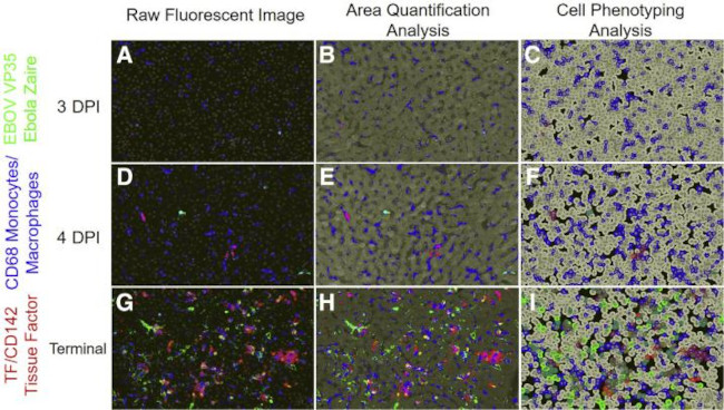 CD142 Antibody in Immunohistochemistry (Paraffin) (IHC (P))