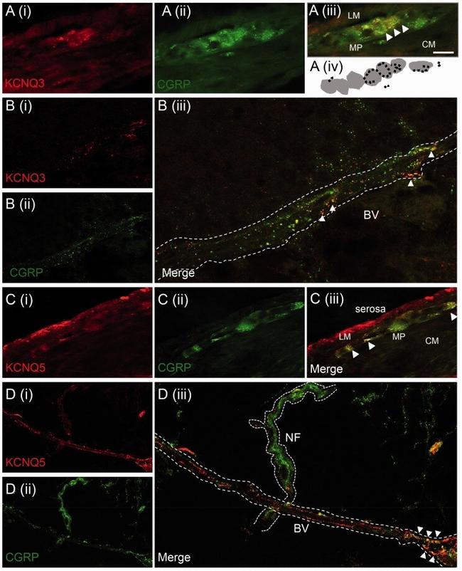 KCNQ5 Antibody in Immunohistochemistry, Immunocytochemistry (IHC, ICC/IF)