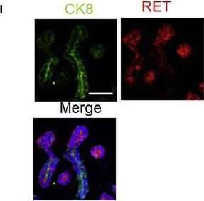Goat IgG (H+L) Cross-Adsorbed Secondary Antibody in Immunocytochemistry (ICC/IF)