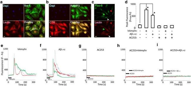 Calcitonin Receptor Antibody in Immunocytochemistry (ICC/IF)
