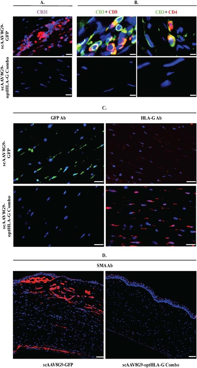 CD4 Antibody in Immunohistochemistry, Immunocytochemistry (IHC, ICC/IF)