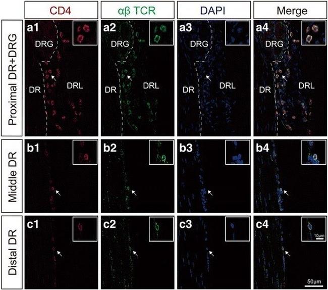 TCR alpha/beta Antibody in Immunohistochemistry, Immunocytochemistry (IHC, ICC/IF)
