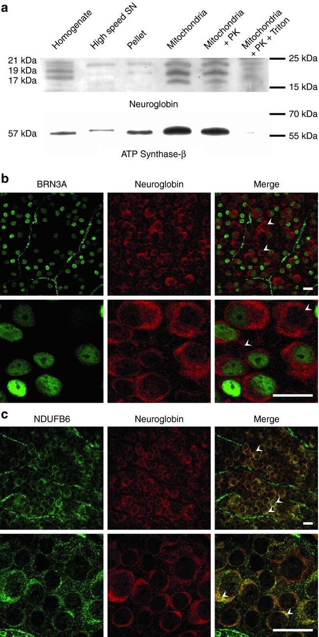 NDUFB6 Antibody in Immunohistochemistry (IHC)