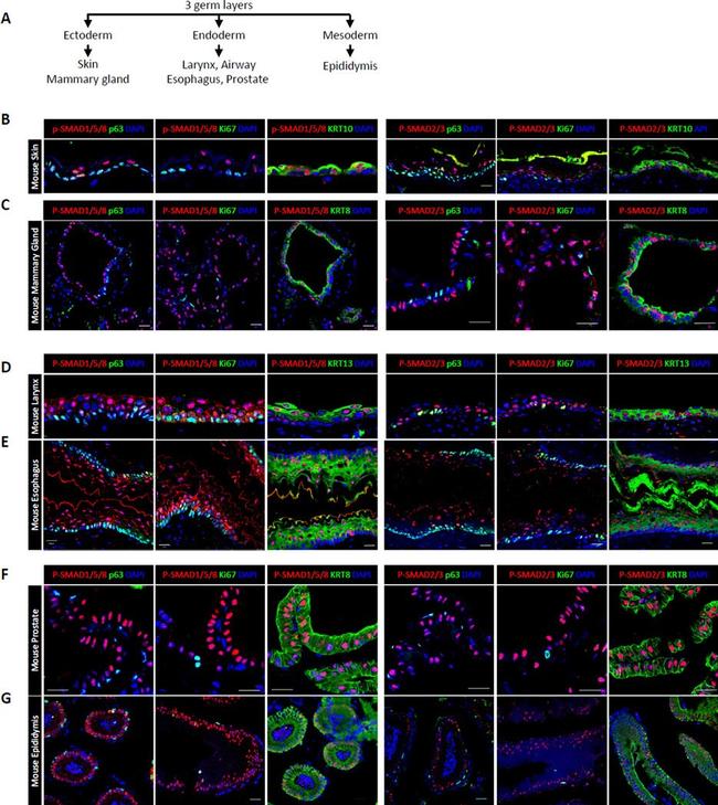 Cytokeratin 13 Antibody in Immunohistochemistry (IHC)