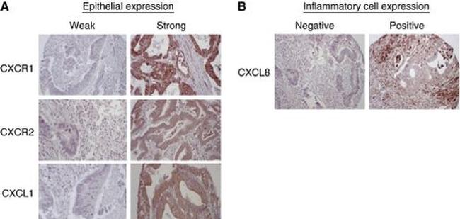 CXCR2 Antibody in Immunohistochemistry (IHC)