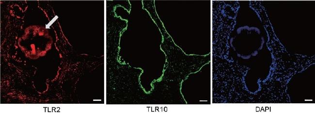 TLR2 Antibody in Immunocytochemistry, Immunohistochemistry (ICC/IF, IHC)