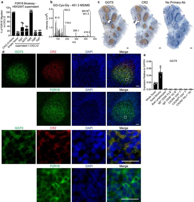 GGT5 Antibody in Immunohistochemistry, Immunocytochemistry (IHC, ICC/IF)