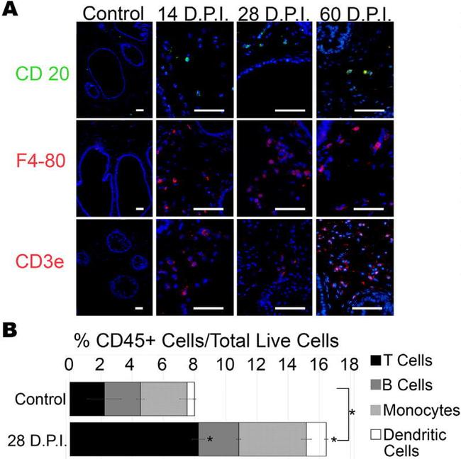 CD3 Antibody in Immunohistochemistry, Immunocytochemistry (IHC, ICC/IF)