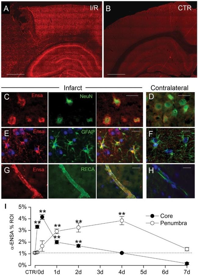 RECA-1 Antibody in Immunohistochemistry, Immunocytochemistry (IHC, ICC/IF)