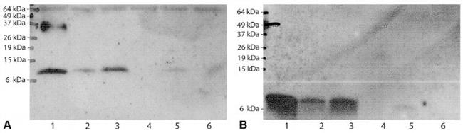 Mycobacterium tuberculosis CFP-10 Antibody in Western Blot (WB)