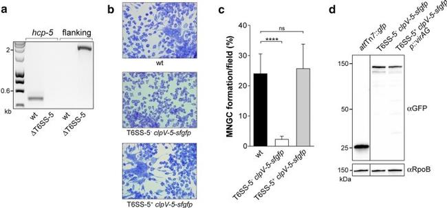 RNA polymerase beta Antibody in Western Blot (WB)