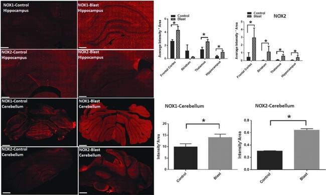 NOX2 Antibody in Immunohistochemistry, Immunocytochemistry (IHC, ICC/IF)