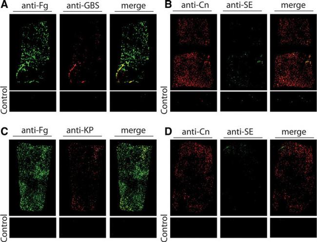 Staphylococcus epidermidis Antibody in Immunocytochemistry (ICC/IF)