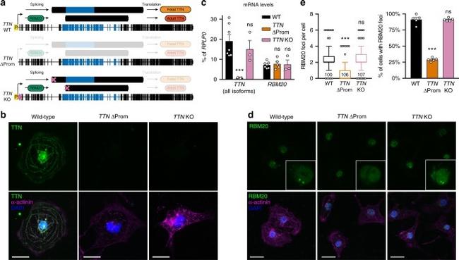 Rbm20 Antibody in Immunocytochemistry (ICC/IF)