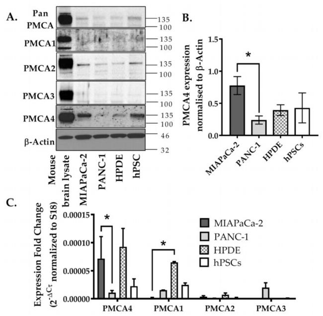 PMCA2 ATPase Antibody in Western Blot (WB)