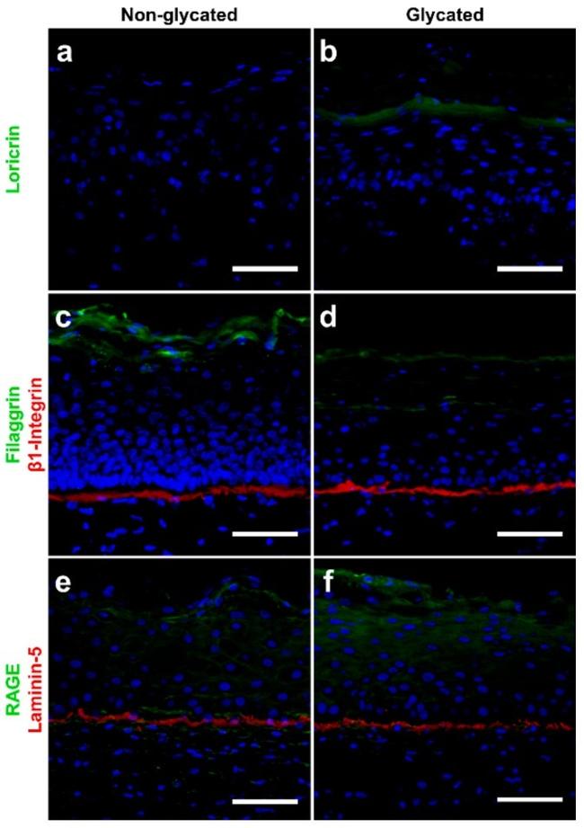 LOR Antibody in Immunohistochemistry, Immunocytochemistry (IHC, ICC/IF)