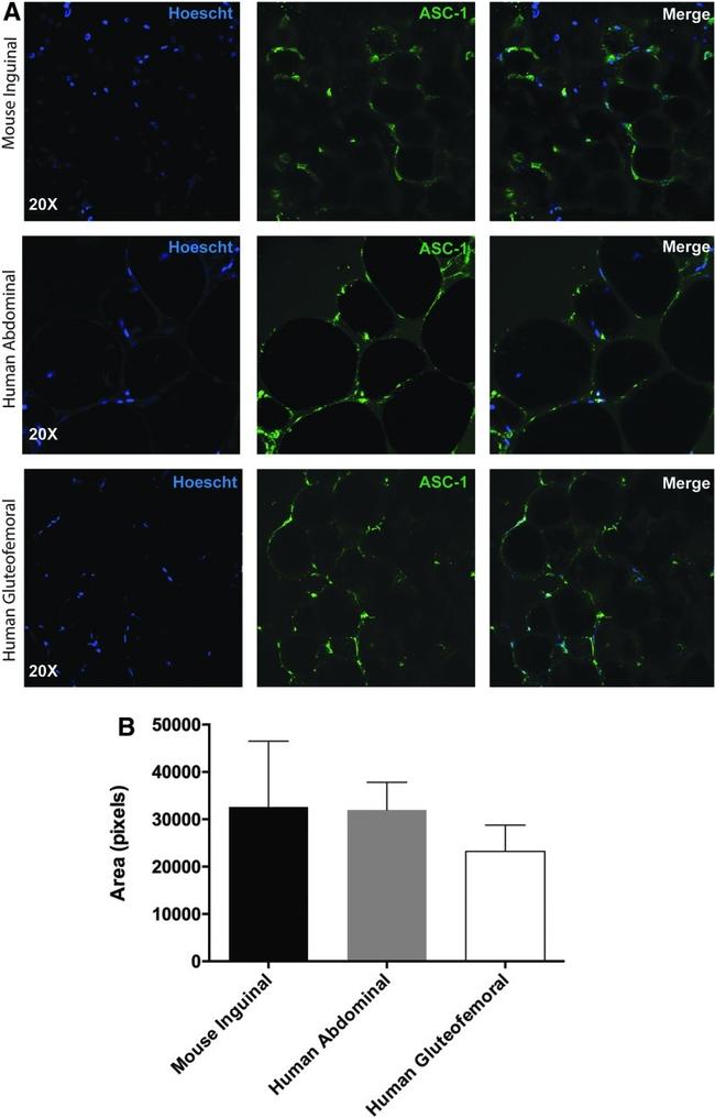 SLC7A10 Antibody in Immunocytochemistry (ICC/IF)