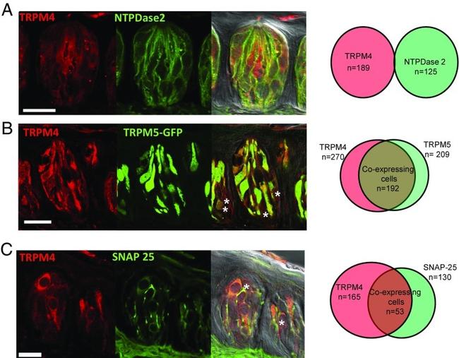 TRPM4 Antibody in Immunohistochemistry, Immunocytochemistry (IHC, ICC/IF)
