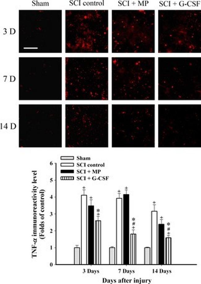 TNF alpha Antibody in Immunohistochemistry, Immunocytochemistry (IHC, ICC/IF)