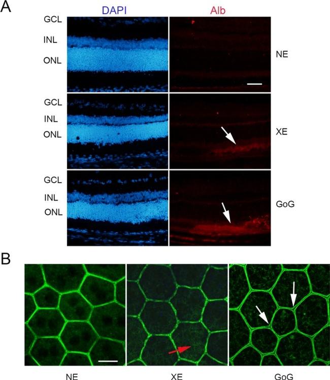 Rat Albumin Antibody in Immunohistochemistry (IHC)